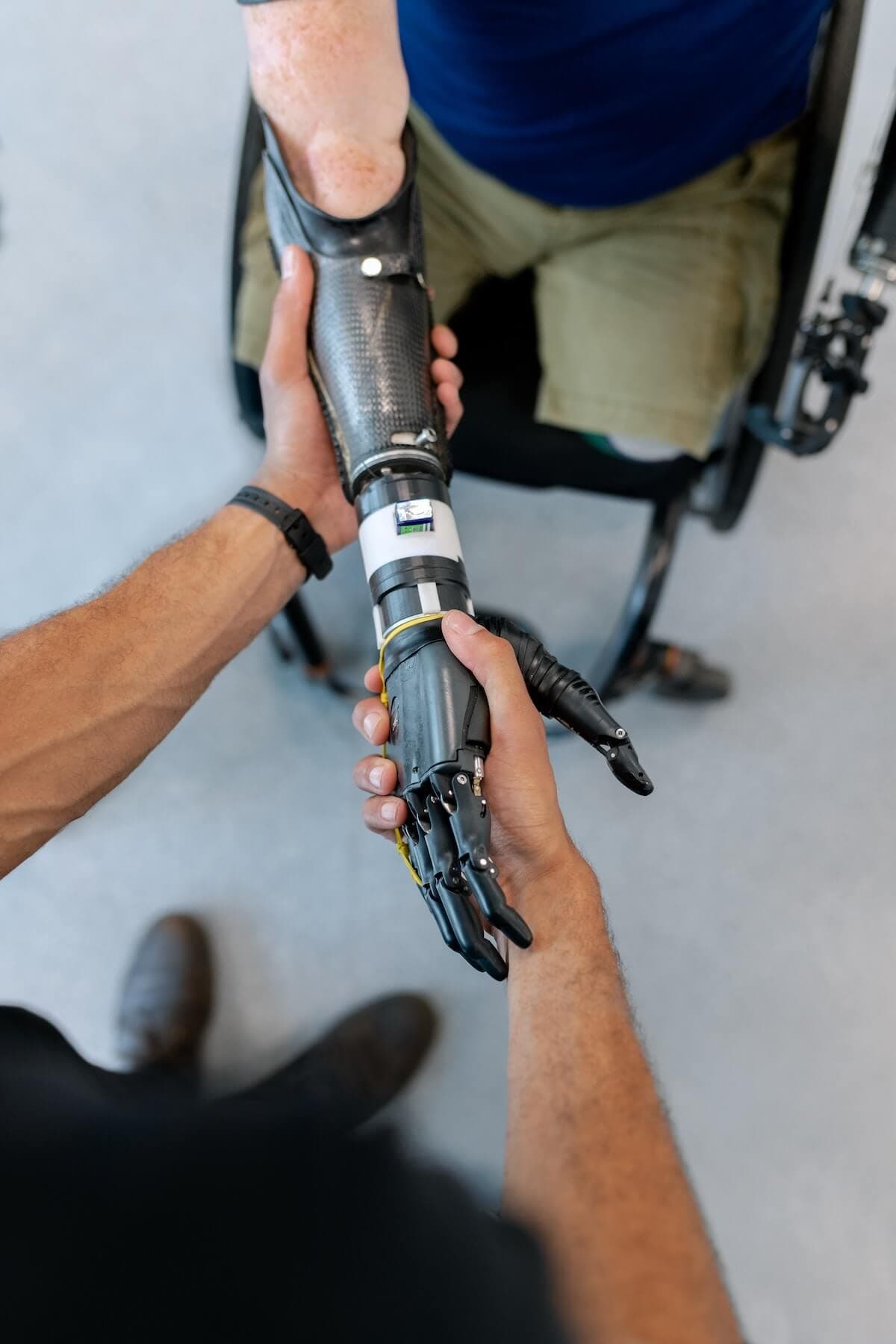 Carbon Fiber Prosthetic